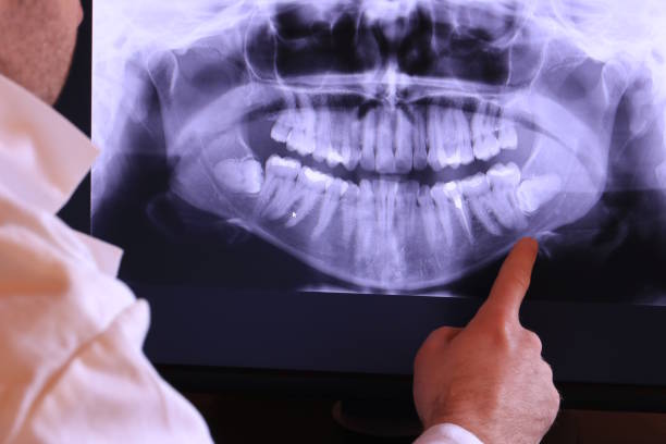 Best After-Hours Emergency Dentist in Rossmoor, NJ