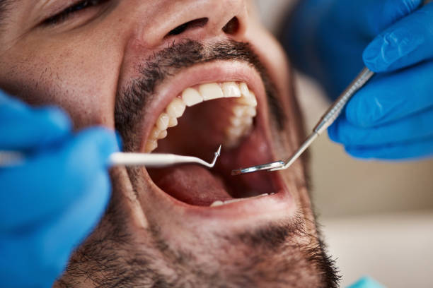 Best Emergency Treatment for Toothache in Rossmoor, NJ