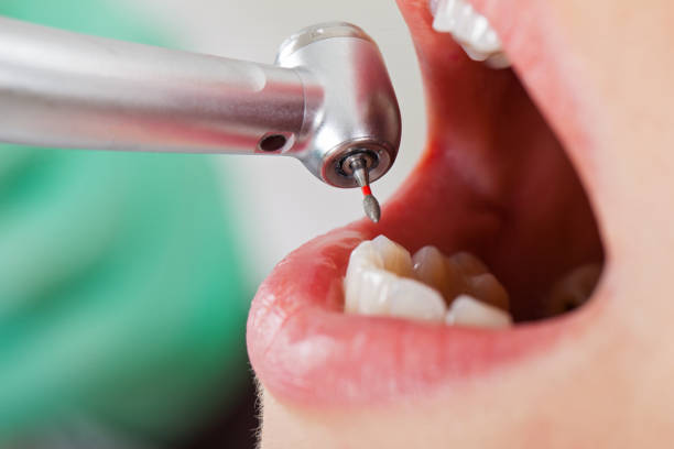 Best Emergency Broken Tooth Repair in Rossmoor, NJ
